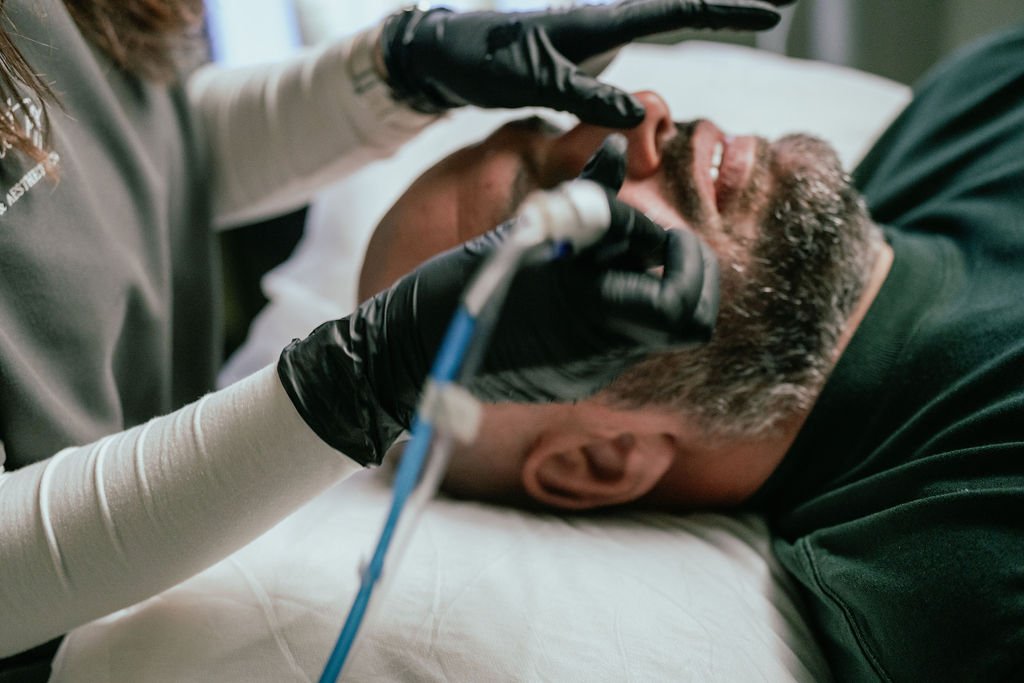 HydraFacial device in use during treatment at Eternity Laser and Aesthetics Dural